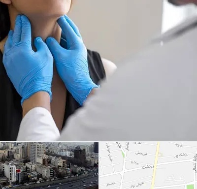 دکتر سرطان گلو در زرتشت