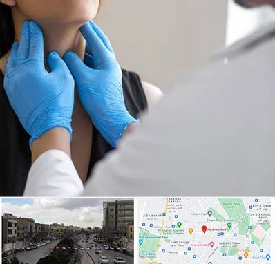 دکتر سرطان گلو در بلوار فردوسی مشهد 