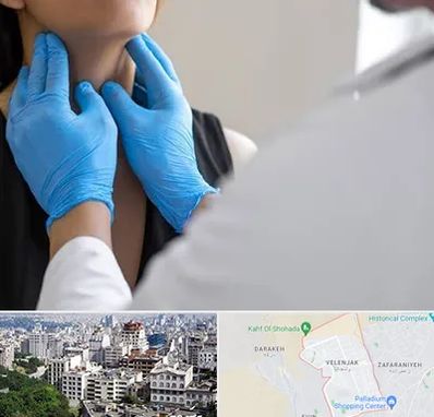 دکتر سرطان گلو در ولنجک 