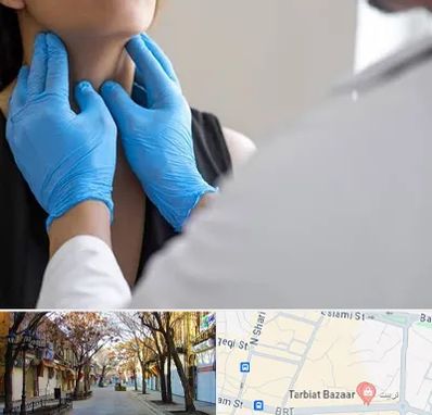 دکتر سرطان گلو در تربیت تبریز