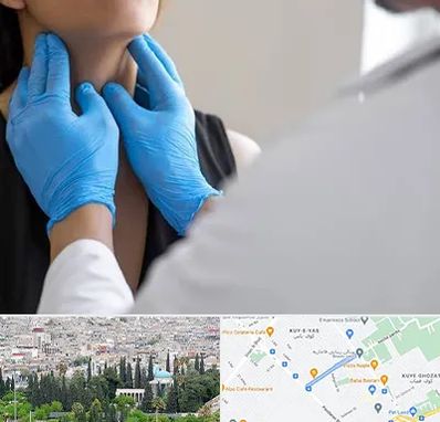 دکتر سرطان گلو در محلاتی شیراز 