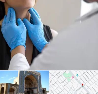 دکتر سرطان گلو در مصلی مشهد