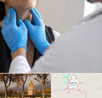 دکتر سرطان گلو در تویسرکان