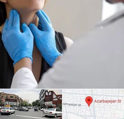 دکتر سرطان گلو در خیابان آذربایجان