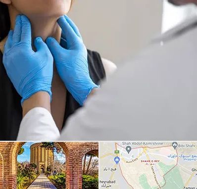 دکتر سرطان گلو در شهر ری