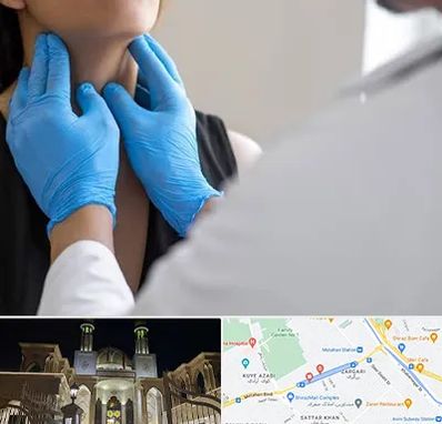 دکتر سرطان گلو در زرگری شیراز 