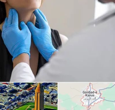 دکتر سرطان گلو در گنبد کاووس