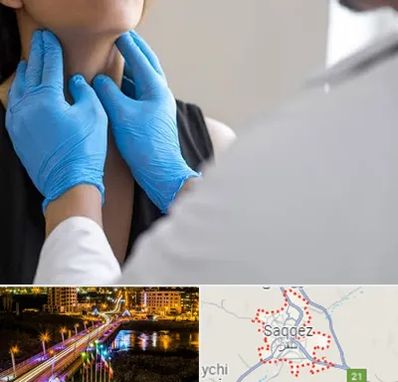 دکتر سرطان گلو در سقز