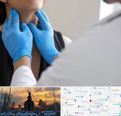 دکتر سرطان گلو در میدان حر 