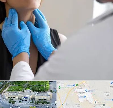 دکتر سرطان گلو در نسیم شهر