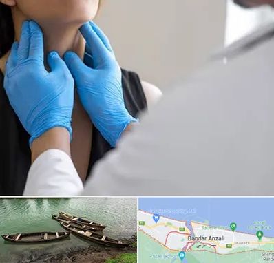 دکتر سرطان گلو در بندر انزلی