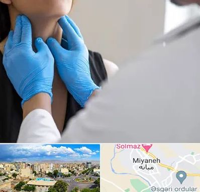 دکتر سرطان گلو در میانه