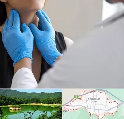 دکتر سرطان گلو در بهشهر