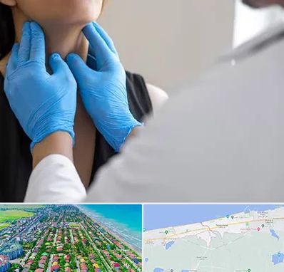 دکتر سرطان گلو در فریدونکنار