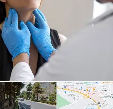 دکتر سرطان گلو در مهرویلا کرج 