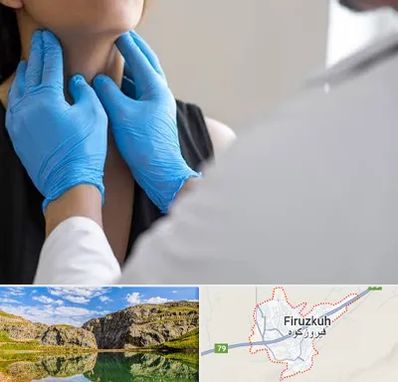 دکتر سرطان گلو در فیروزکوه
