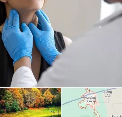 دکتر سرطان گلو در کردکوی