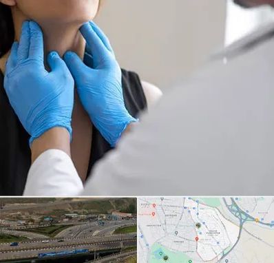 دکتر سرطان گلو در یاغچیان تبریز