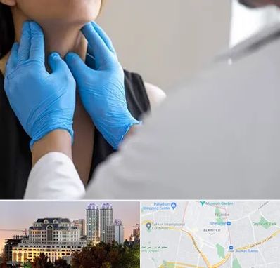 دکتر سرطان گلو در فرشته 