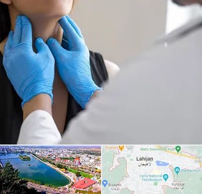 دکتر سرطان گلو در لاهیجان