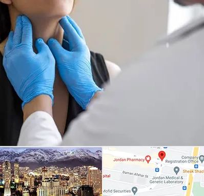 دکتر سرطان گلو در جردن 