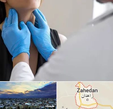 دکتر سرطان گلو در زاهدان