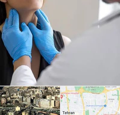 دکتر سرطان گلو در مرزداران 