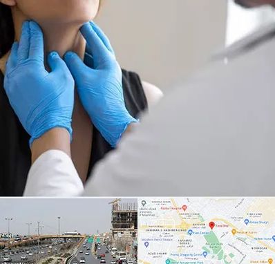 دکتر سرطان گلو در بلوار توس مشهد 