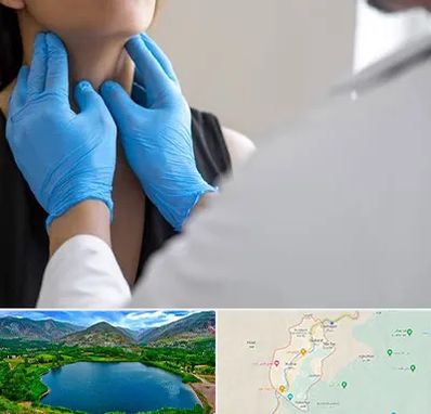 دکتر سرطان گلو در رودبار