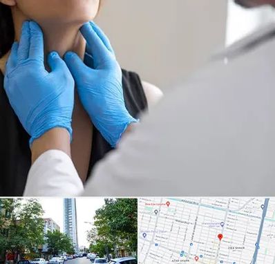 دکتر سرطان گلو در امامت مشهد 