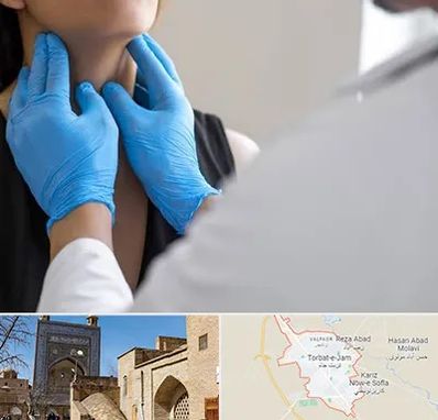 دکتر سرطان گلو در تربت جام