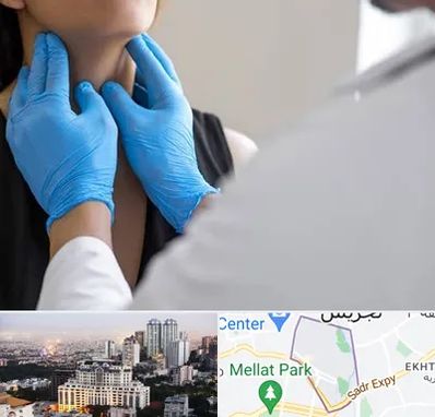 دکتر سرطان گلو در الهیه 