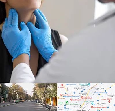 دکتر سرطان گلو در شریعتی 