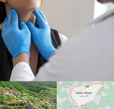 دکتر سرطان گلو در قائم شهر