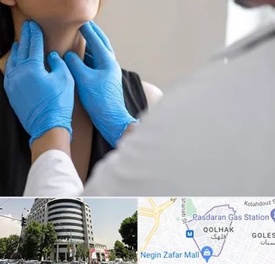 دکتر سرطان گلو در قلهک 