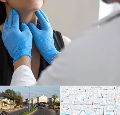 دکتر سرطان گلو در ضیابری رشت 