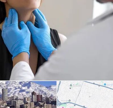 دکتر سرطان گلو در ازگل