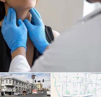 دکتر سرطان گلو در 17شهریور