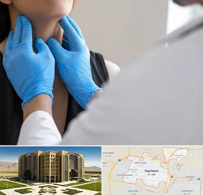 دکتر سرطان گلو در نجف آباد