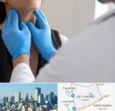 دکتر سرطان گلو در قیطریه 