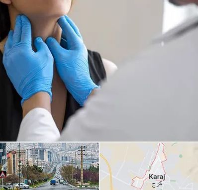 دکتر سرطان گلو در گوهردشت کرج 