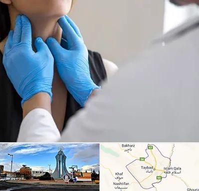 دکتر سرطان گلو در تایباد