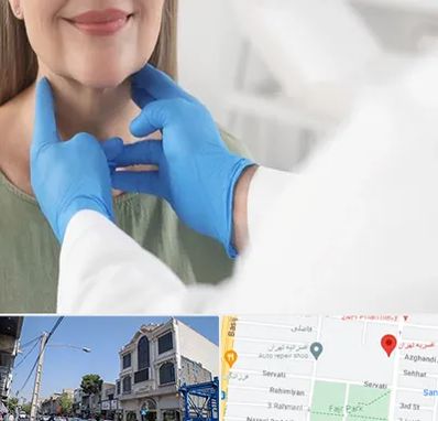 جراح سرطان گلو در افسریه