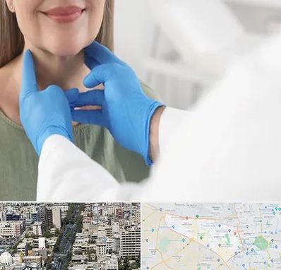 جراح سرطان گلو در منطقه 18 تهران 