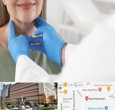 جراح سرطان گلو در سهروردی 