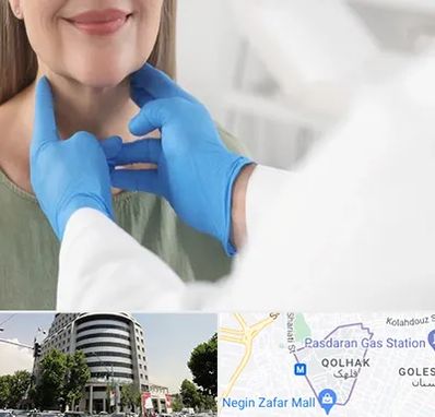 جراح سرطان گلو در قلهک 