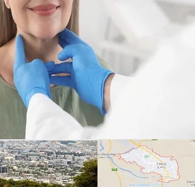 جراح سرطان گلو در یاسوج