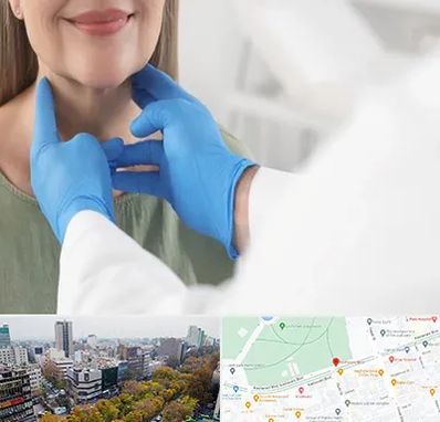 جراح سرطان گلو در بلوار کشاورز 