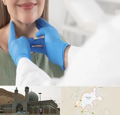 جراح سرطان گلو در شهرضا