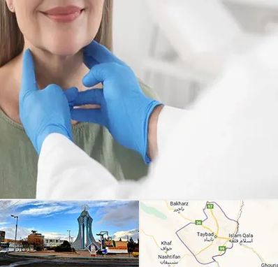 جراح سرطان گلو در تایباد